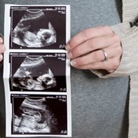 https://connect.bcbsok.com/cfs-file/__key/communityserver-blogs-components-weblogfiles/00-00-00-00-09/PregnancyBabyUltrasound.jpg